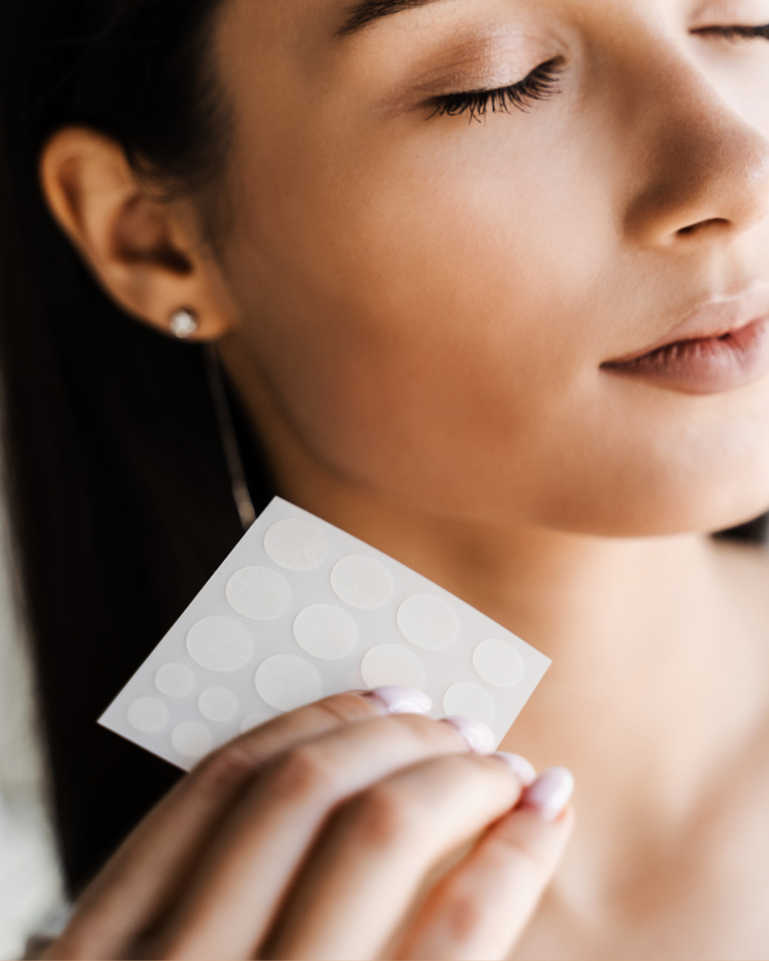Pimple Patches - parches hidrocoloides